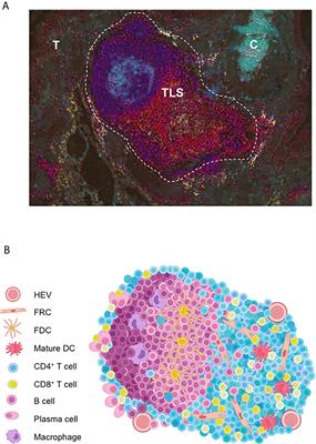 Tumor-Associated Tertiary Lymphoid Structures: From Basic and Clinical Knowledge to Therapeutic Manipulation